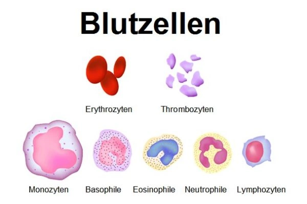 Eosinophilie Facharztwissen