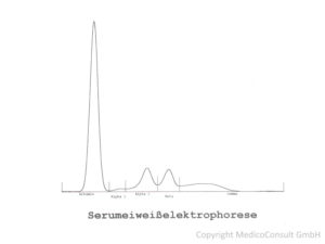 Normale Serum-Elektrophorese.